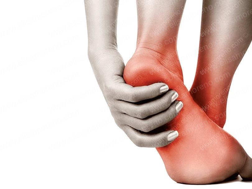 Fisioterapia en la Fascitis Plantar
