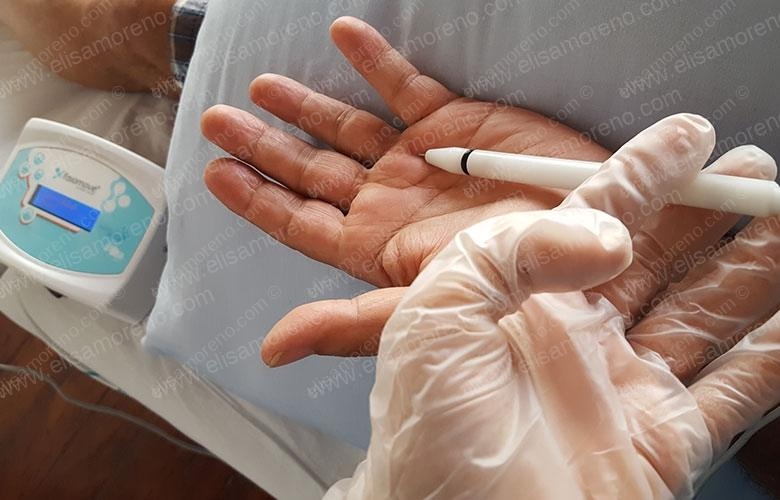 Dedo en Gatillo o en Resorte